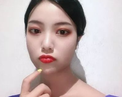 西安双眼皮修复，西安双眼皮修复多少钱？