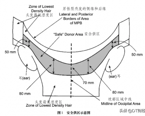 西安植发机构排行，一张图搞明白你植发需要多少钱？