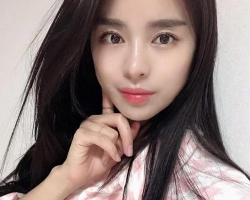 西安割双眼皮价格，西安做双眼皮多少钱？